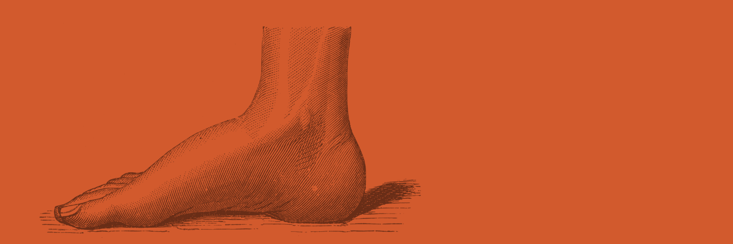 Akut pakkeforløb for diabetiske fodsår